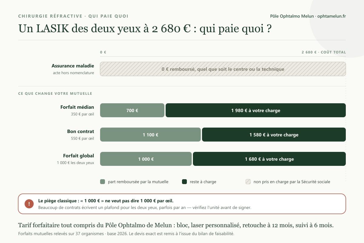 Graphique du reste à charge d'un LASIK des deux yeux à 2 680 € selon le forfait de la mutuelle, l'Assurance maladie ne remboursant rien